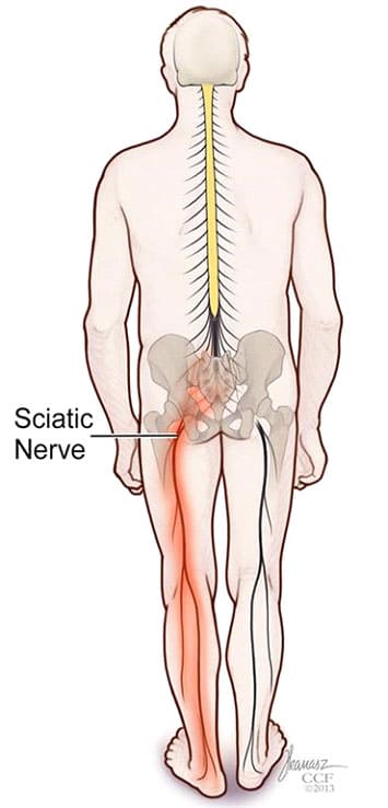 Sciatic Pain Cushion, Active Therapy Clinic