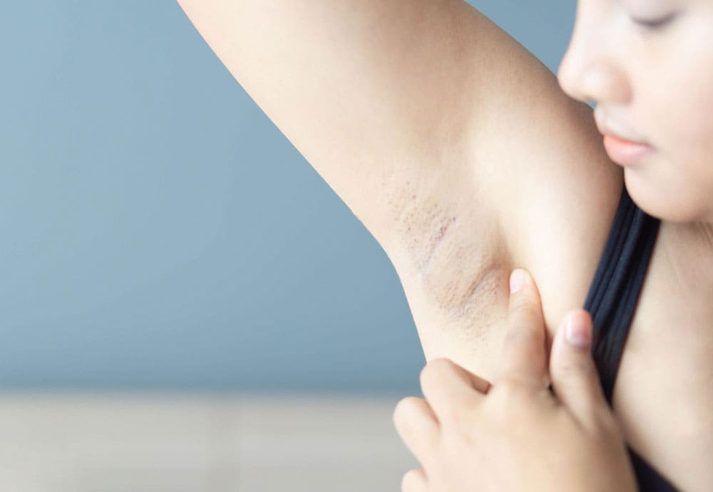 Causes,Symptoms of Armpit pain & its treatment