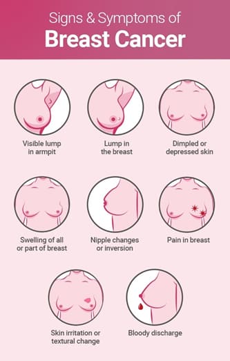 Breast tenderness, sore nipples, and other breast changes during