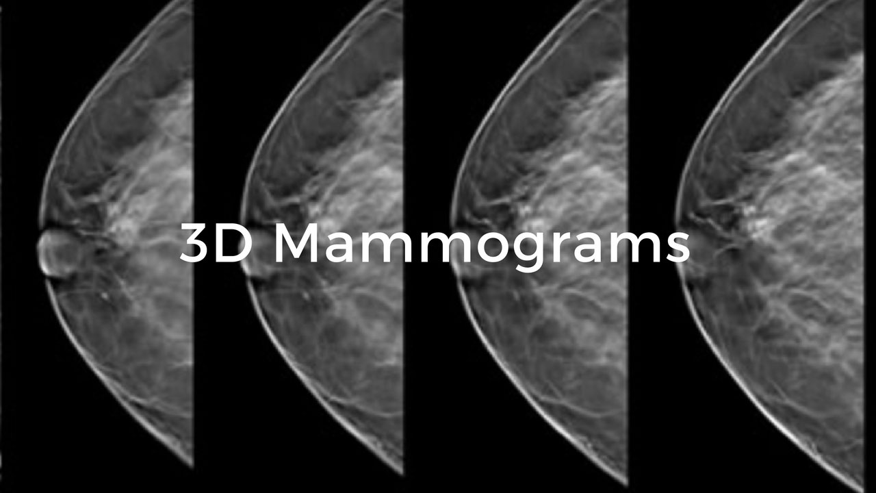 3d Mammogram