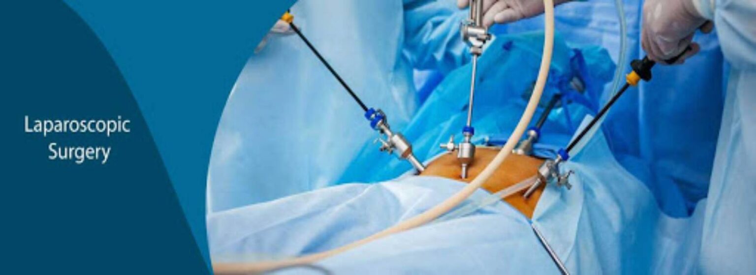 Pelvic Laparoscopy Surgery