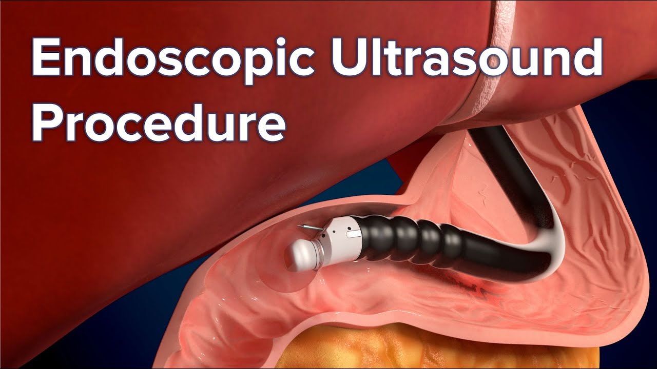 Endoscope